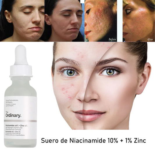 𝐓𝐡𝐞 𝐎𝐫𝐝𝐢𝐧𝐚𝐫𝐲. Niacinamide 10% 30ml IMPORTADO🇺🇲